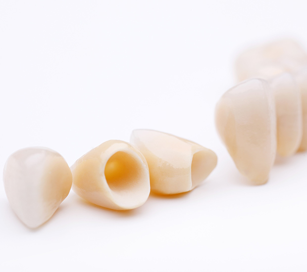 Cedar Park Dental Crowns and Dental Bridges