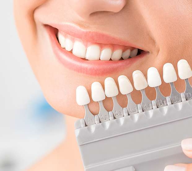Cedar Park Dental Veneers and Dental Laminates