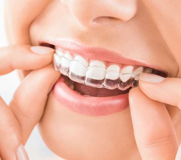 Cedar Park Does Invisalign Really Work
